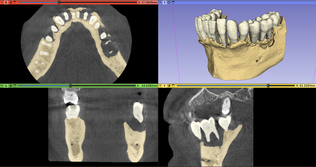 Sample segmentation